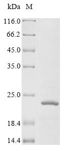 Insulin-like growth factor 1 receptor (IGF1R), partial, human, recombinant