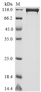 Dipeptidyl peptidase 4 (DPP4), human, recombinant