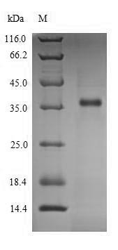 L-lactate dehydrogenase C chain (LDHC), partial, human, recombinant