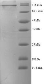 Prolyl endopeptidase FAP (FAP), partial, human, recombinant