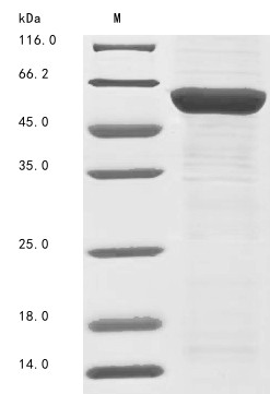 Thyroid hormone receptor alpha (THRA), human, recombinant