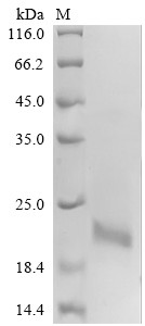 Calcitonin gene-related peptide 1 (CALCA), partial, human, recombinant