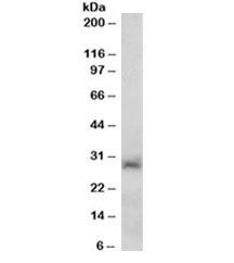 Anti-SIRT3