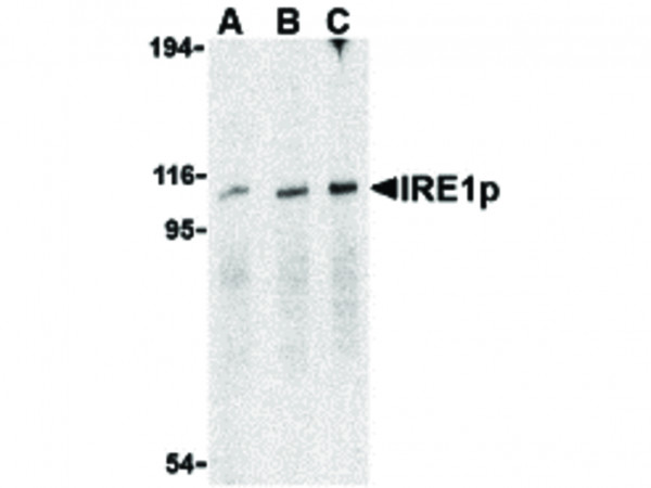 Anti-IRE1p