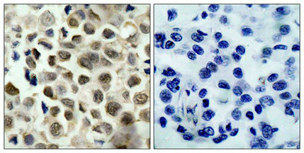 Anti-Phospho-HDAC8 (Ser39)