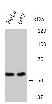 Anti-CYP11B1