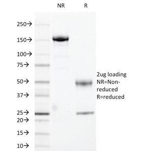 Anti-HLA-DR (MHC II), clone 169-1B5.2