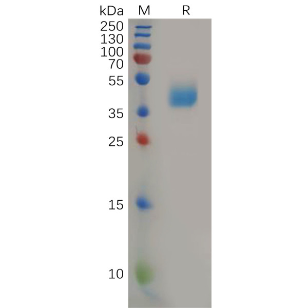 Human CCR2 Protein, hFc Tag