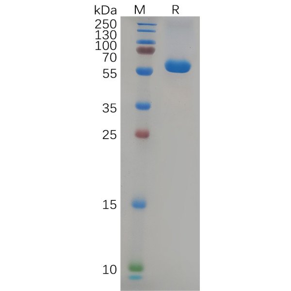 SARS-CoV-2 (Delta) S protein RBD , hFc Tag
