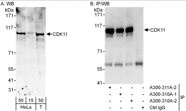 Anti-CDK11