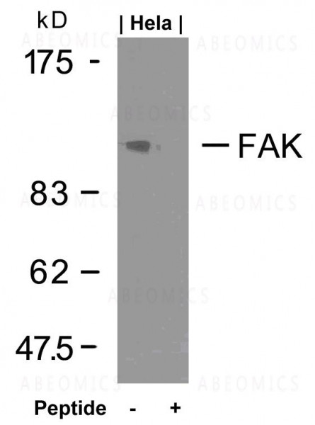 Anti-FAK (Ab-925)