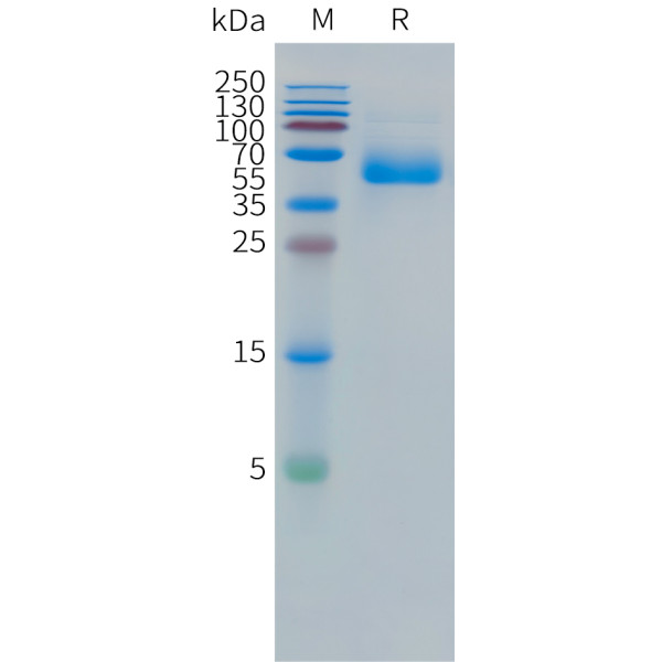 Human CEACAM5(589-685) Protein, hFc Tag