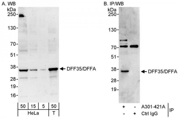 Anti-DFF35/DFFA