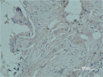 Anti-PGR Monoclonal