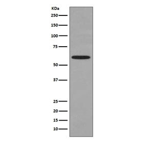 Anti-HSP60, clone DOI-8