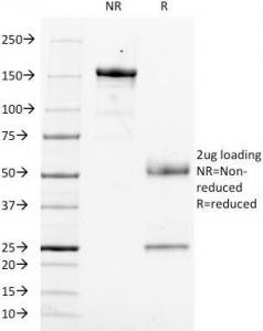 Anti-CD14 (Monocyte and Macrophage Marker), clone LPSR/553