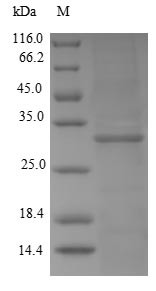 Kallikrein-2 (KLK2), human, recombinant