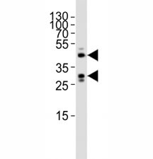 Anti-SIRT3