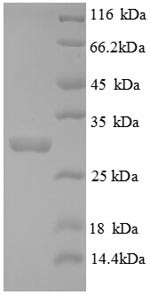 Tryptase (Tpsab1), partial, mouse, recombinant