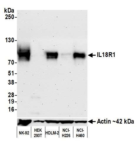 Anti-IL18R1 Recombinant Monoclonal