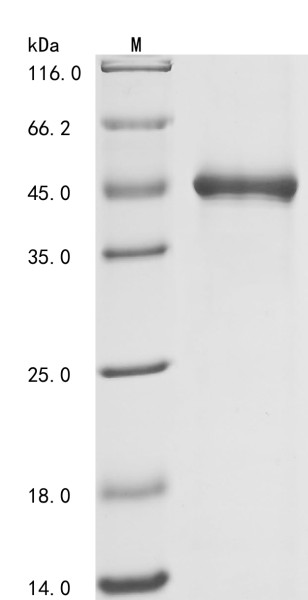 Low affinity immunoglobulin gamma Fc region receptor III-B (FCGR3B), partial, human, recombinant