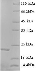 GTPase KRas (KRAS), partial, human, recombinant