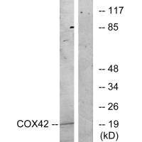 Anti-COX4I2