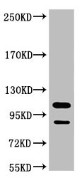 Anti-PARP1 Monoclonal