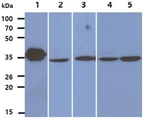 Anti-Lactate Dehydrogenase B, clone 14D7