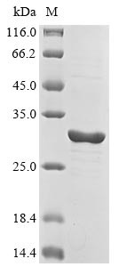 Neuronal acetylcholine receptor subunit beta-2 (CHRNB2), partial, human, recombinant