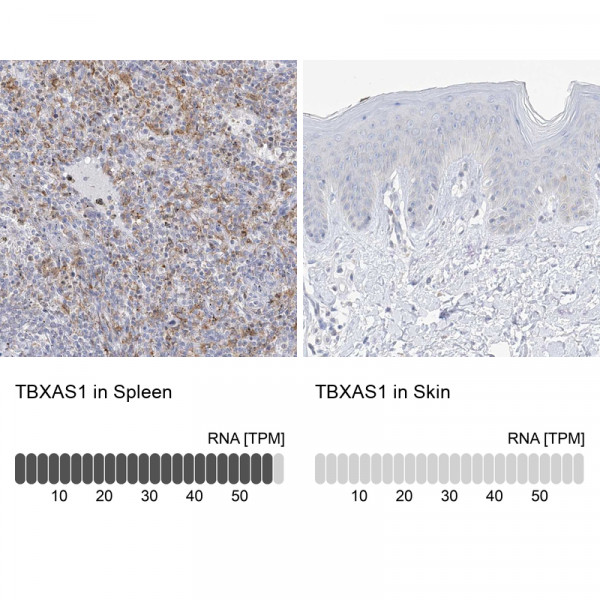 Anti-TBXAS1