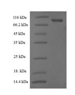 Cytosolic non-specific dipeptidase (CNDP2), human, recombinant