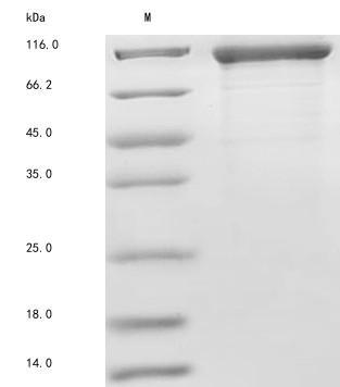 Fc receptor-like protein 5 (FCRL5), partial, human, recombinant