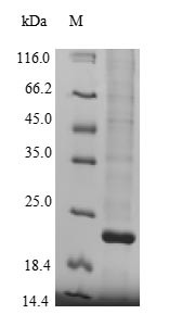 Lysine-specific demethylase 5A (KDM5A), partial, human, recombinant