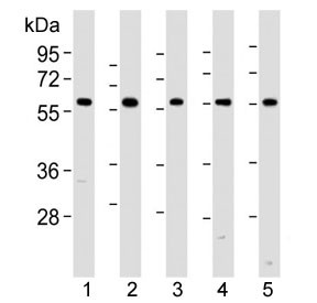 Anti-Pyruvate Kinase / PKM2