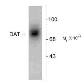 Anti-Dopamine Transporter antibody, Extracellular Loop 2