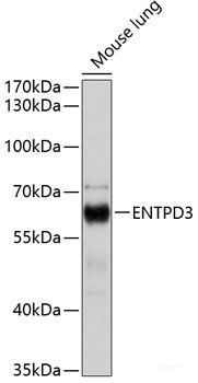 Anti-ENTPD3