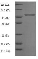 Geranylgeranyl pyrophosphate synthase (GGPS1), human, recombinant