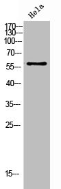 Anti-Phospho-CHEK2 (T383)