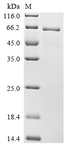 Ryanodine receptor 1 (RYR1), partial, human, recombinant