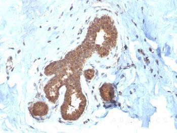 Anti-Glutathione S-Transferase Mu2 (GSTM2) Monoclonal Antibody (Clone: CPTC-GSTMu2-2)