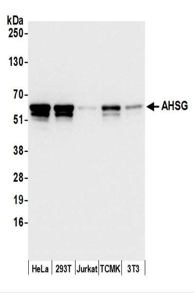 Anti-AHSG/Fetuin-A