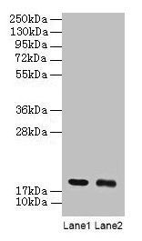 Anti-UBE2I