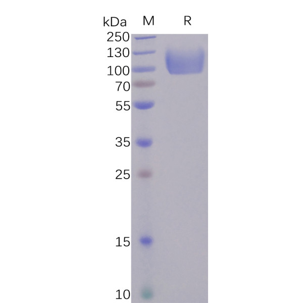 Human CD155 Protein, hFc tag