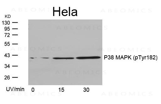 Anti-phospho-P38 MAPK (Tyr182)