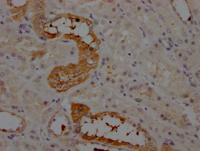 Anti-AGT Recombinant Monoclonal, clone 8A9