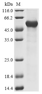 Scavenger receptor cysteine-rich type 1 protein M160 (CD163L1), partial, human, recombinant