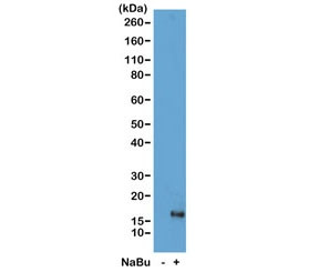 Anti-H3K79ac / Acetyl Histone H3 Lysine 79, clone RM156 (recombinant antibody)