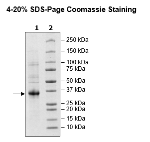 Spike S1 RBD, Avi-His-tag, Biotin-labeled (SARS-CoV-2)