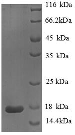 Phospholipase A2, membrane associated (PLA2G2A), human, recombinant